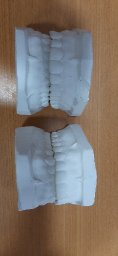 MODELO DE YESO DENTADO