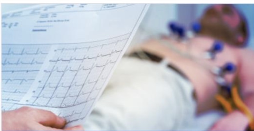 Electrocardiograma