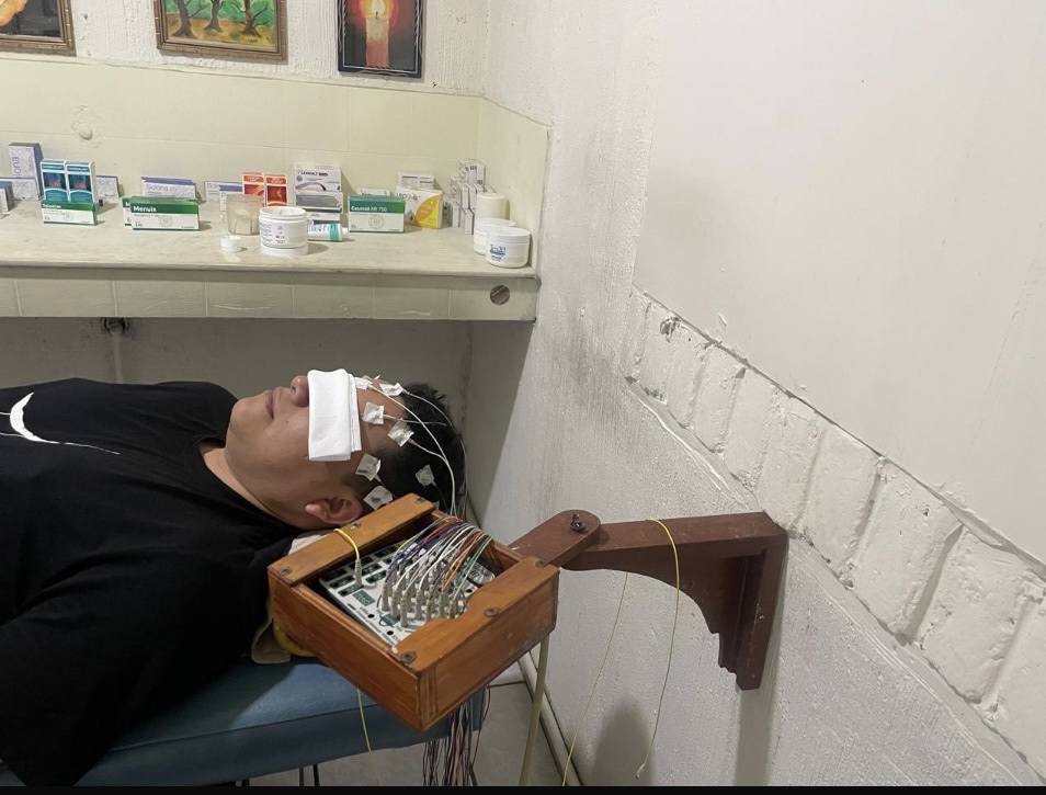 Electroencefalograma