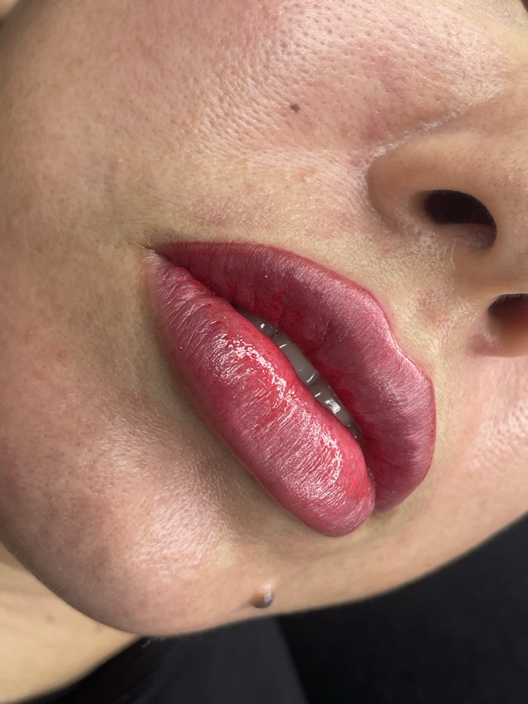 Micro labial