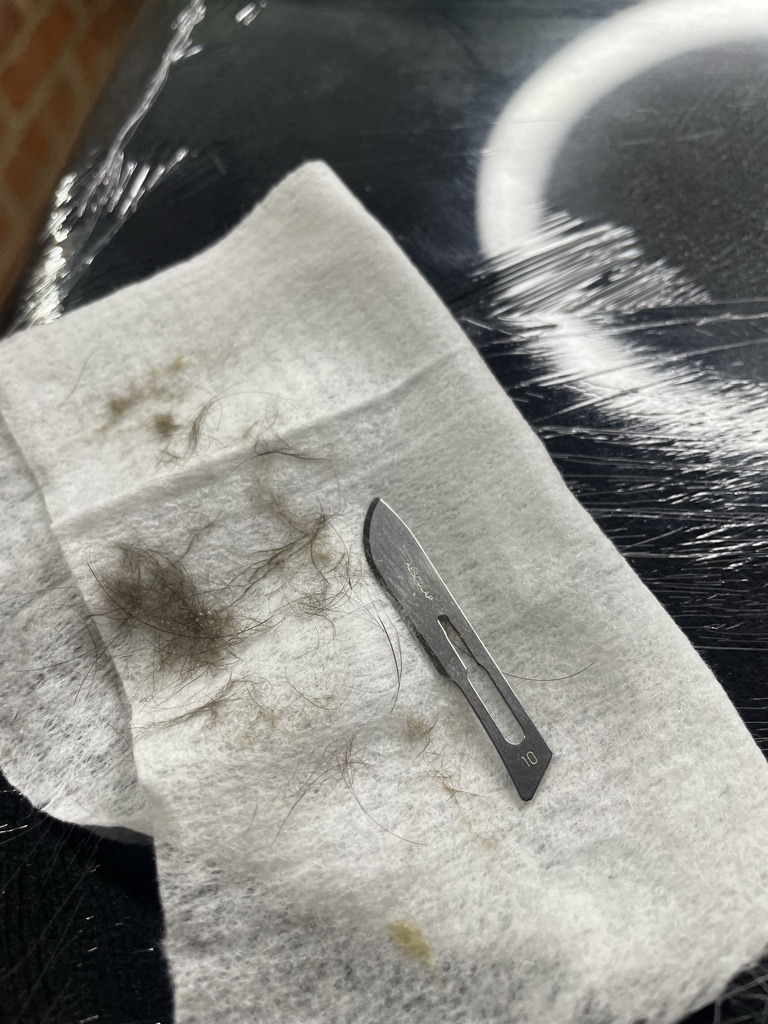 Dermaplaning