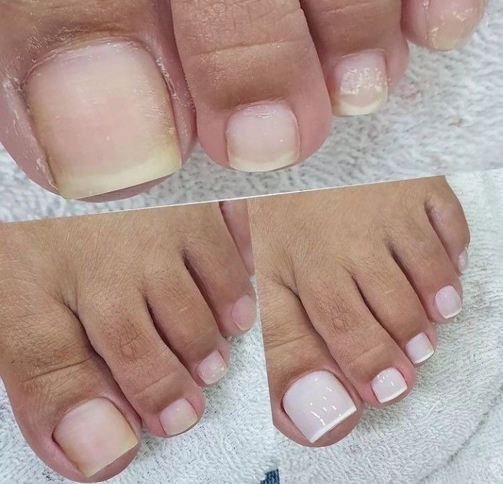 Pedicure tradicional