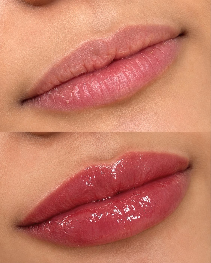 Hydra lips + color