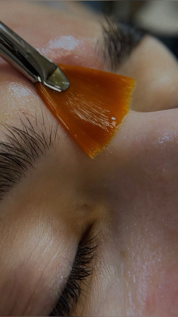Peeling facial