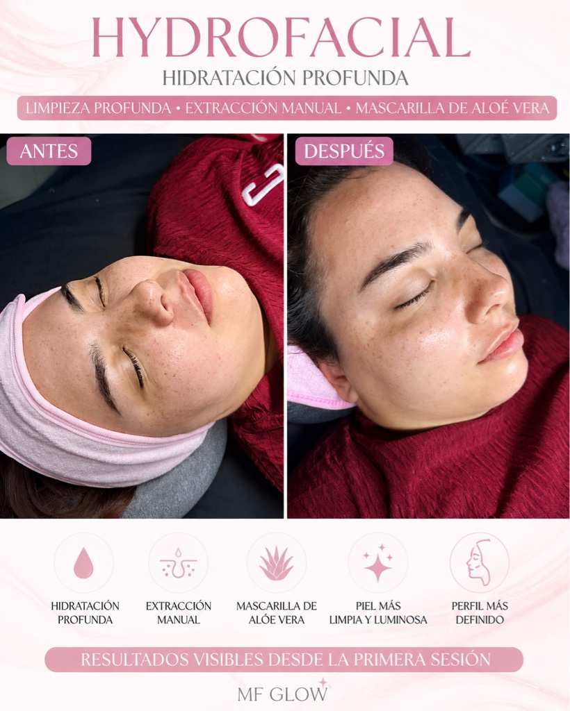 Hydrofacial