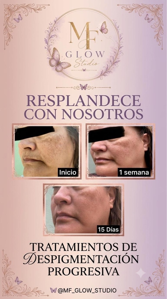 Crema quita paño