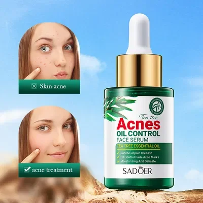 SADOER SÉRUM FACIAL ANTIACNÉ ÁRBOL DE TÉ 30ML 42446 X1