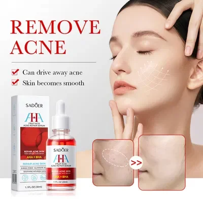 SADOER SERUM FACIAL CON ACIDOS EXFOLIANTES 30ML 39934 X1