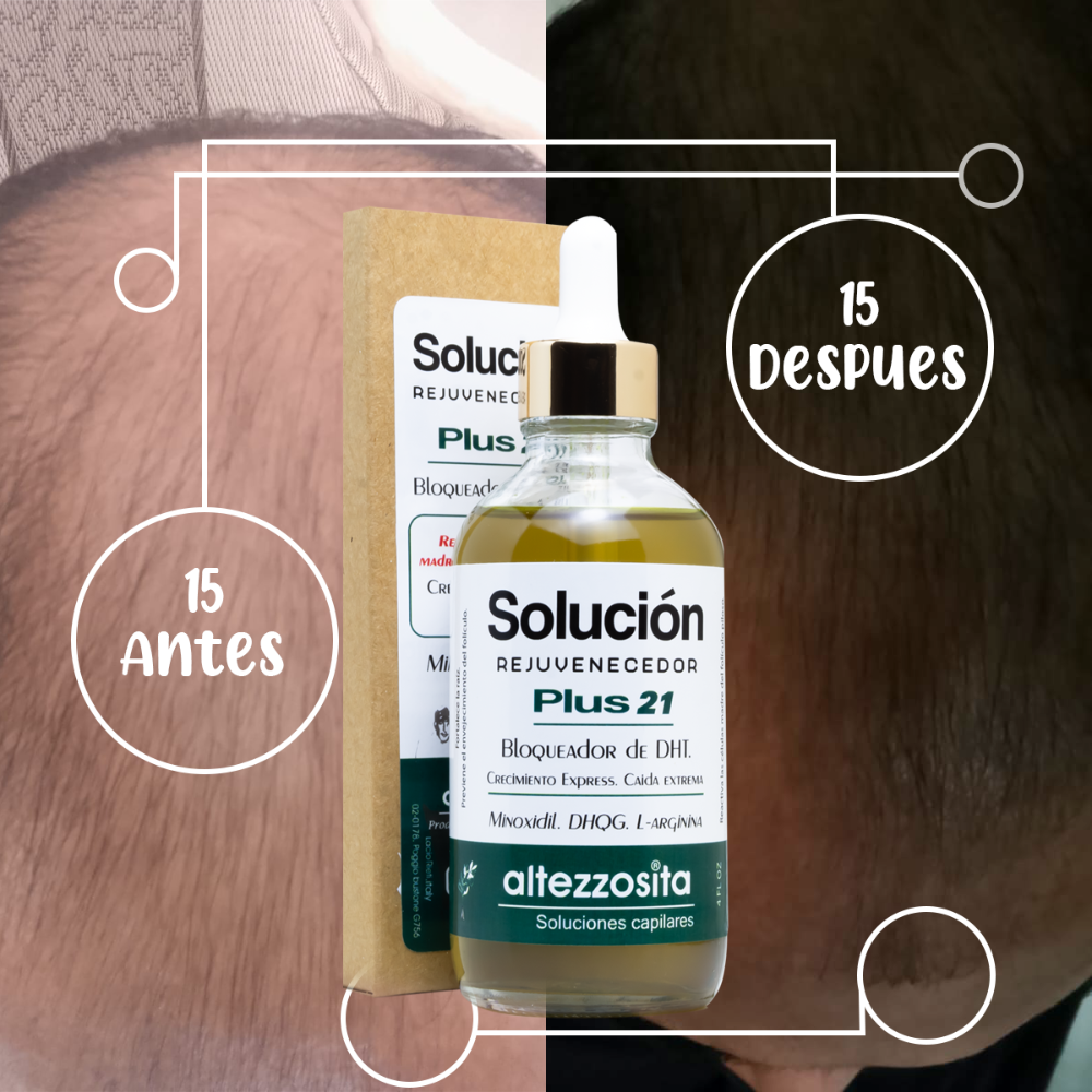 Solución Plus 21 Tratamiento anti-alopecia Altezzosita By Alejandro Pimentel