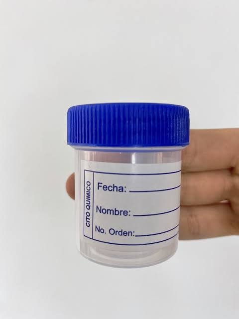 Uroanalisis