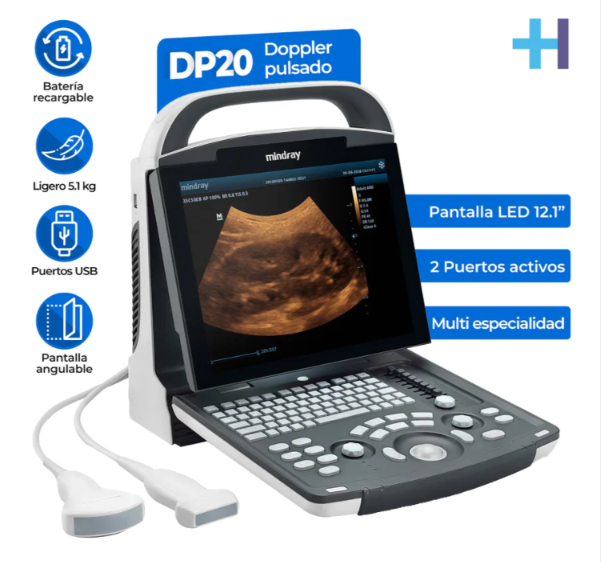 Ultrasonido Portátil para Uso Humano DP20 con función Doppler Pulsado y mejoradores de imagen iBeam y iClear - Marca Mindray